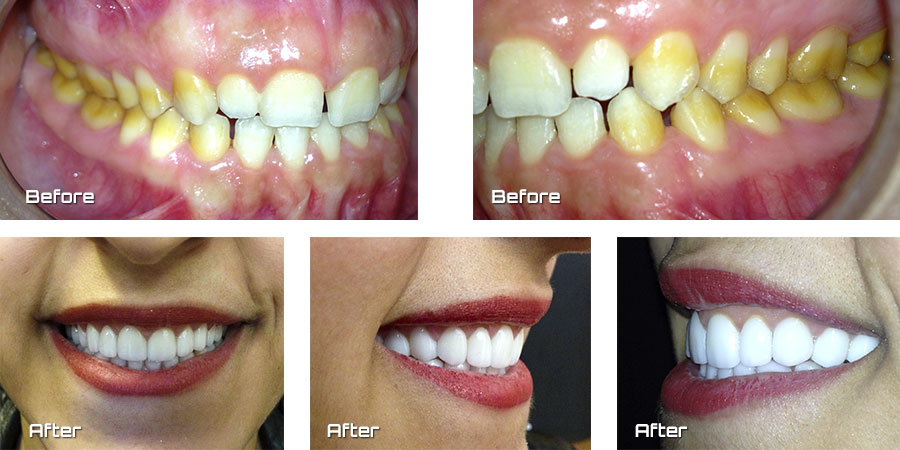 Oral Rehabilitation