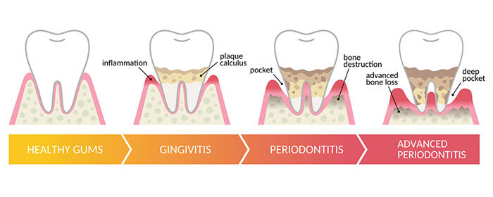 periodontics
